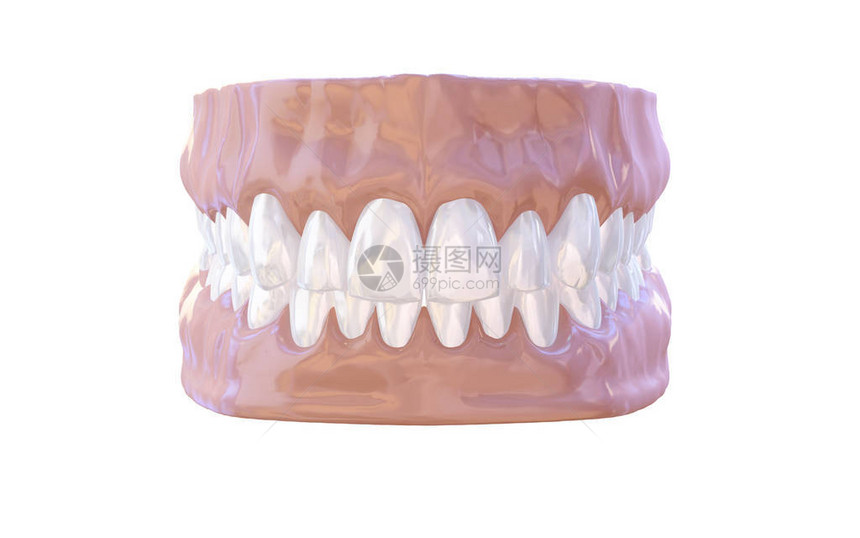 人类下巴与牙齿和牙龈解剖模型医学插图隔离在白色背景上图片