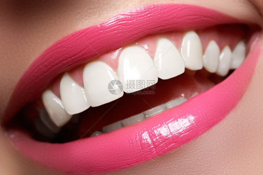 漂白前后的完美笑容牙齿护理和美白牙齿用洁白健康的牙齿微笑健康的女牙齿微笑和感图片