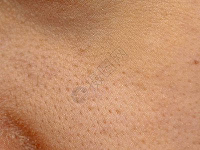亚洲女干脸上的大毛孔皮肤女鼻子和脸颊皮肤问题毛孔粗大白背景