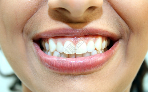 牙齿健康的女微笑特写图片