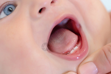 母亲张开婴儿嘴检查第一颗牙齿婴儿乳牙列儿童保背景图片