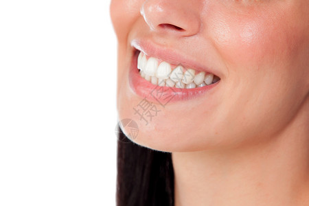 微笑的女人嘴巴长着大牙齿特写图片