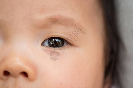 亚洲婴儿眼睛和鼻子的宏观镜头图片