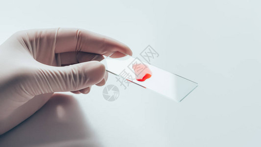白手套医生用玻璃胶片和血液样本拍摄的带图片
