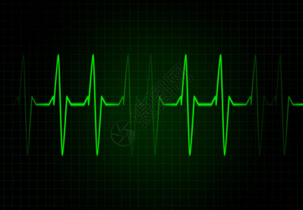 绿色的心脏频率图片