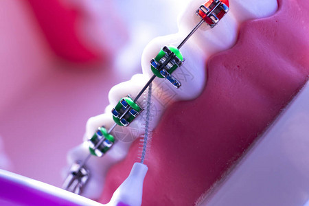 带牙套对准器的每颗牙齿之间的牙齿清洁刷图片