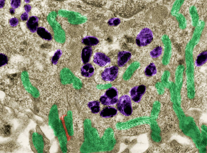 假彩色透射电子显微镜TEM显微照片显示皮肤上皮细胞中的黑色素颗粒图片