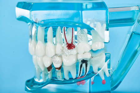 用蓝色隔离的白牙中红色牙根的牙齿模型图片