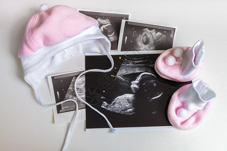 女婴的超声波照片和衣物很多期待怀图片