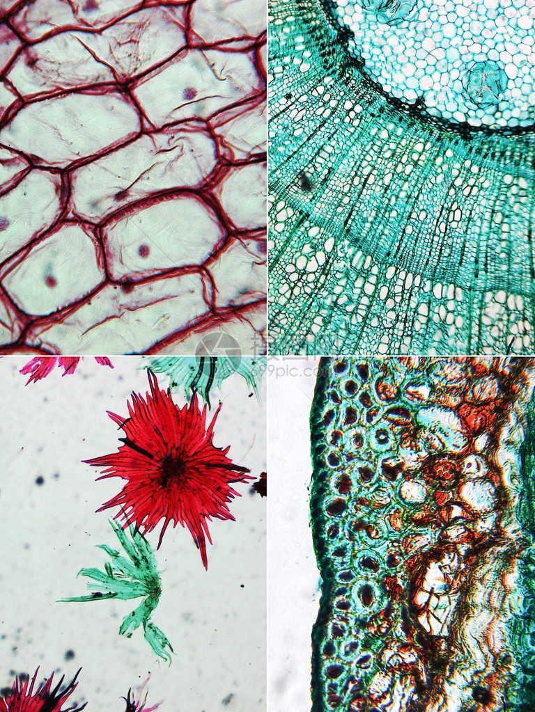 通过显微镜看到的红洋葱细胞左上苹果左下和松树木部分右图片