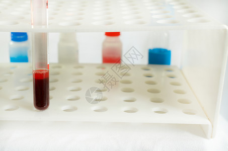 血样采和分析在一个生化实验室中进行图片