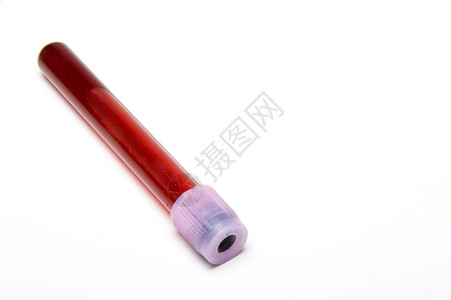玻璃实验室试管中的血样图片