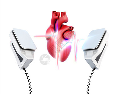 模型心脏的概念图象和白底的除颤器释放3d插图action设计图片