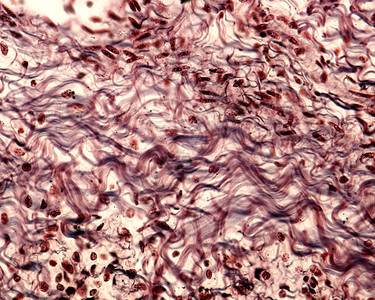 用银法染色的结缔组织中的胶原纤维束胶原纤维呈现典型图片
