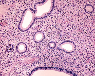 人类子宫内膜增殖期几个管状子宫内膜腺体被横切显示其简单的柱状上皮其中背景图片