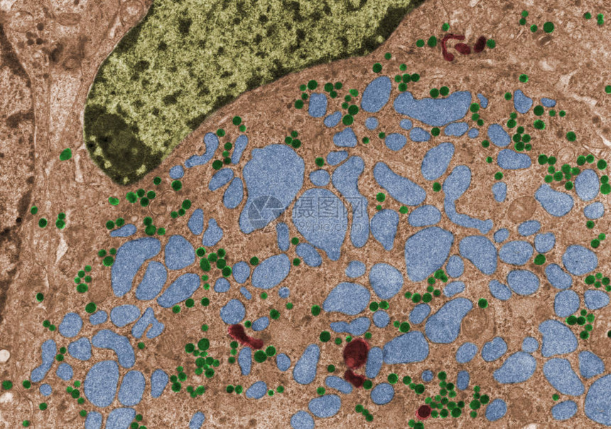 去势动物促腺细胞的假彩色透射电子显微镜TEM显微照片显示FSLLH颗粒图片