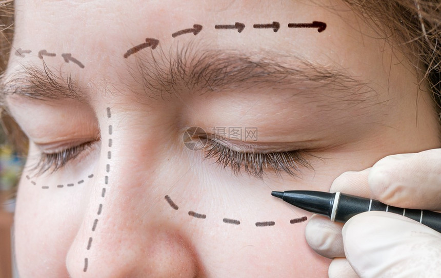 面部整形手术手在眼睛周围用记号笔画线图片