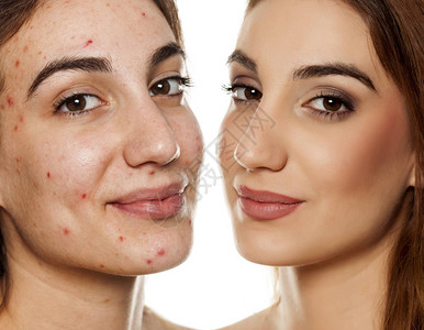 化妆品治疗前后同一名妇女比较肖像和白底妆色的对比图片