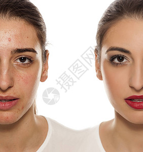 化妆前后皮肤有问题的女脸部比较肖像图图片