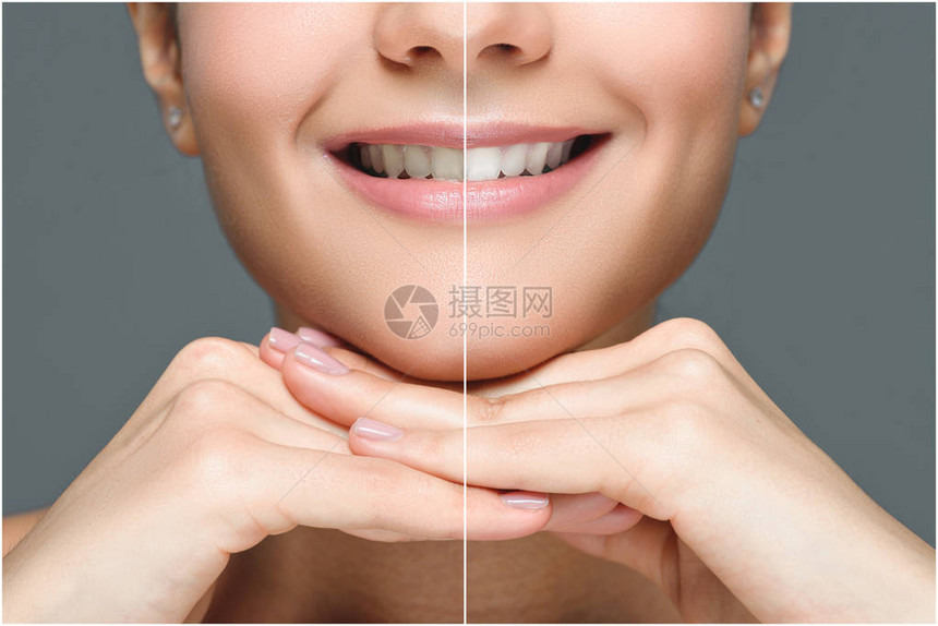 在牙前和牙齿后微笑着女人的部分面孔白地图片