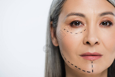 有整形外科手术线的亚洲女脸部被图片