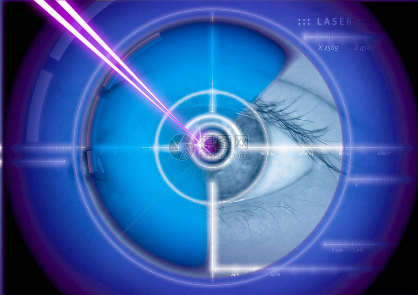 眼部激光手术激光矫正图片