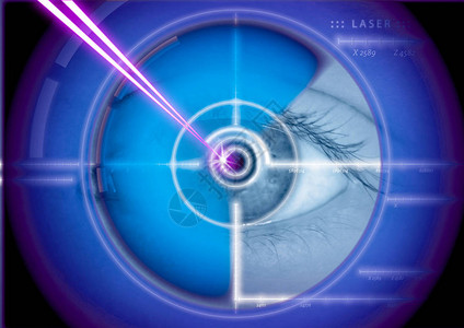 眼部激光手术激光矫正背景图片