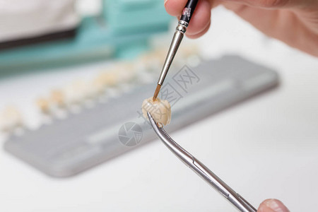 在牙科实验室画一个牙冠图片