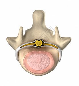 正常的横交圆盘脊髓和核脉冲图片