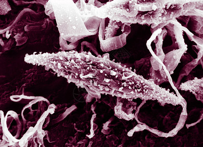 显微镜下小孢子虫病高清图片