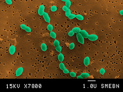 显微镜下的链球菌图片