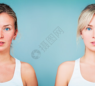 有完美皮肤和皮肤问题的年轻女人治疗后不健康和健康的皮肤面部护理医图片