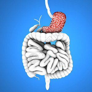 消化道溃疡消化道胃和溃疡蓝色背景下的消化系统背景
