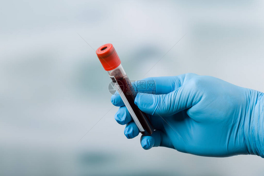 带着蓝色医用手套的手拿着一个血液探针图片