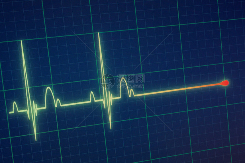 蓝色的医疗心脏监测器ECGEKG心电图图片