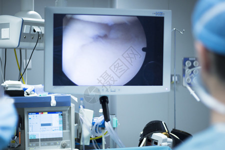 医院钥匙孔显微手术动脉检查操作屏幕图片