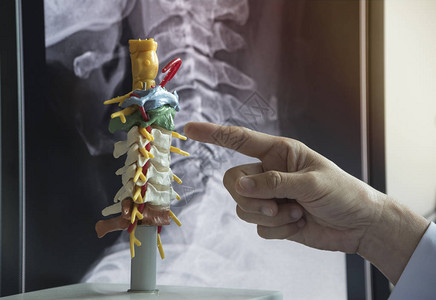 医生指向显示计算机监视器上颈部X光X的宫颈脊图片