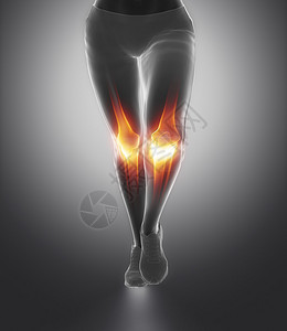 侧重于运动受伤时的膝图片