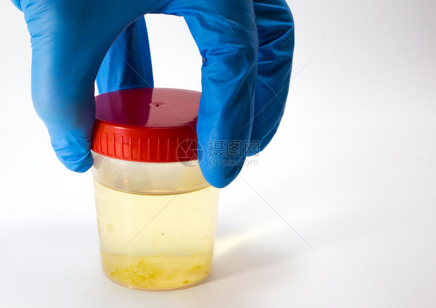 化验室分析员取尿液图片