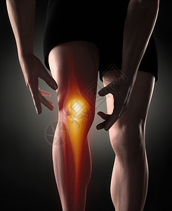 科拉克人膝盖疼痛概念设计图片