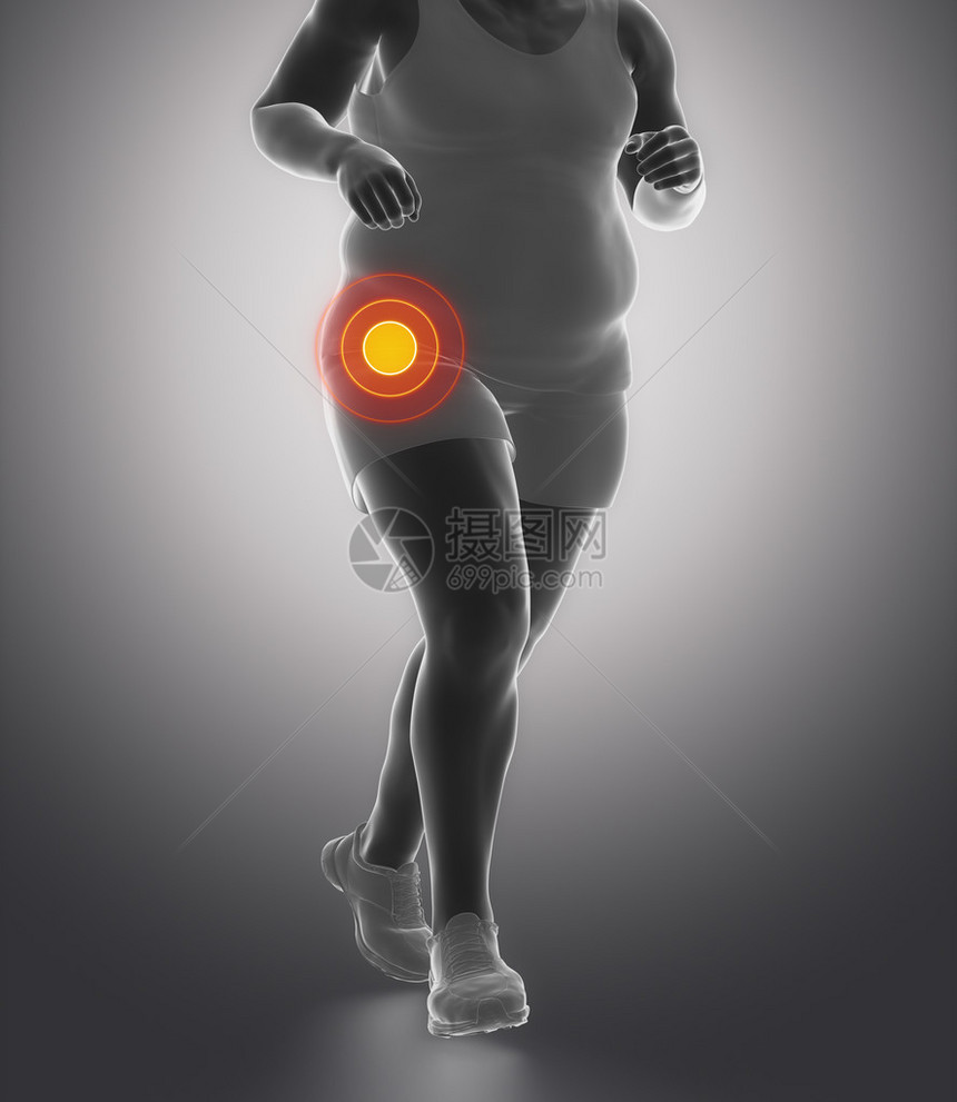 有肥胖问题和髋关节损伤的跑步者图片