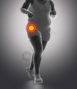 有肥胖问题和髋关节损伤的跑步者图片