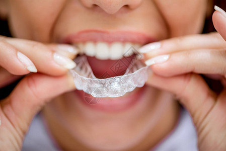 年轻女患者的近视试图在牙齿上安装用于牙科矫正的图片