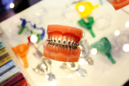 牙科保健示范牙套图片