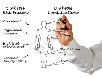 糖尿病综合症绘图片