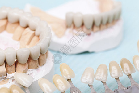 牙修复体和牙齿陶瓷盖图片
