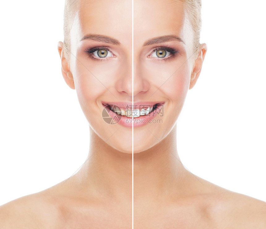 美白手术后的牙齿前后对比美丽的女人上白色孤立的脸牙科口腔医图片