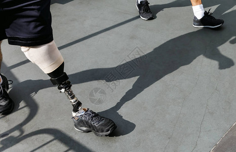 现代脚假肢残疾的有脚假肢的年图片