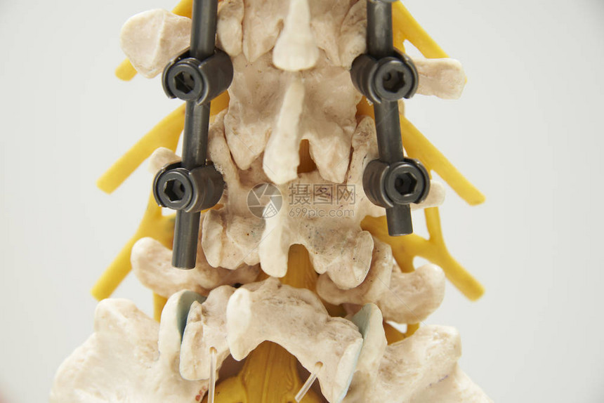 超近后端视图人类腰脊椎模型仪器图片
