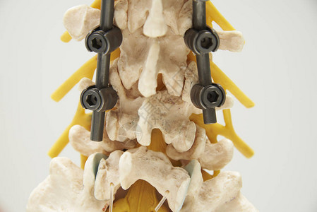 超近后端视图人类腰脊椎模型仪器图片